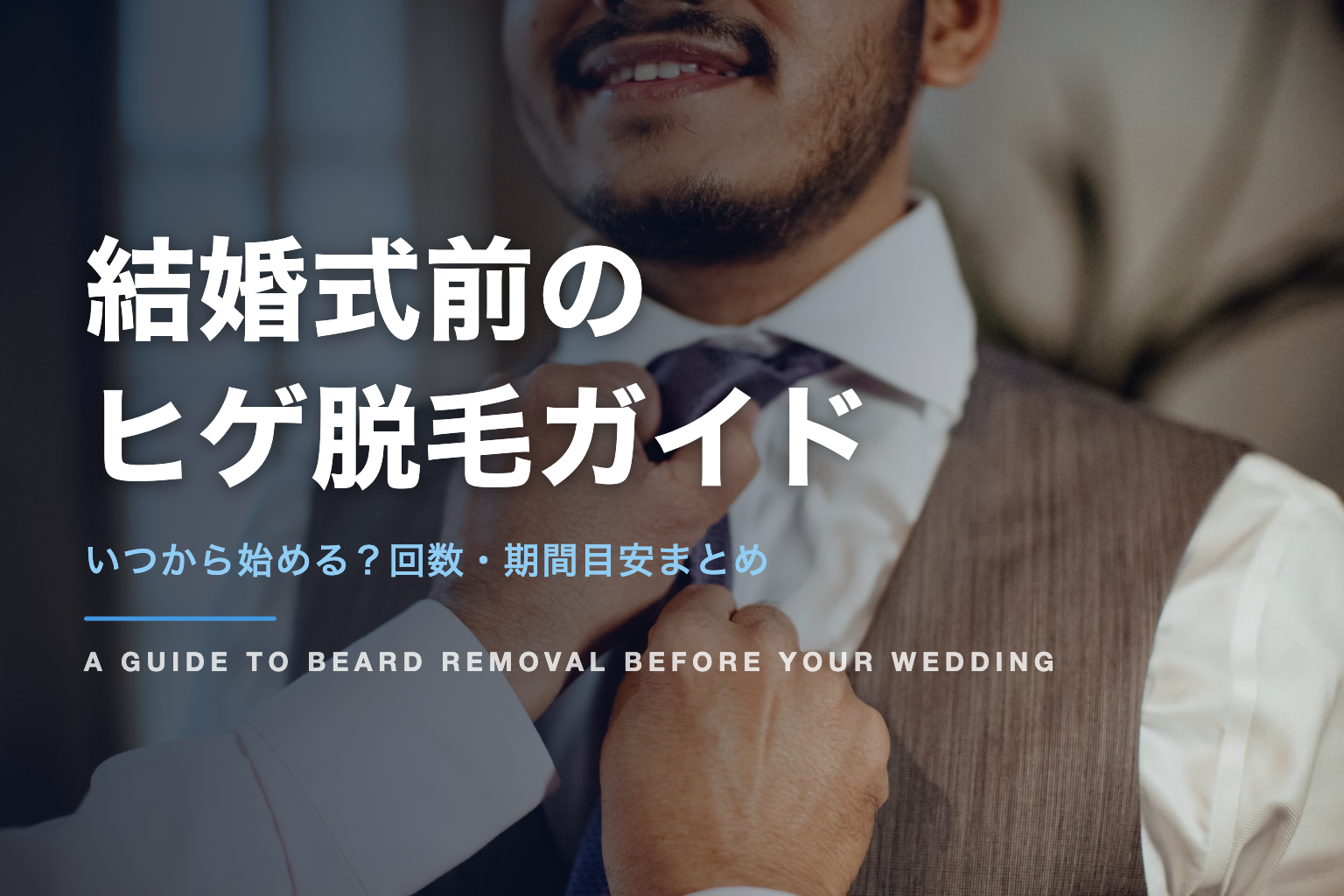 結婚式前のヒゲ脱毛ガイド｜いつから始める？回数・期間目安まとめ